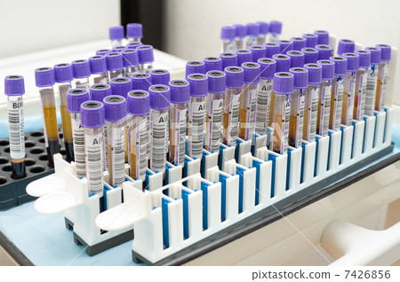 test tubes with blood 7426856