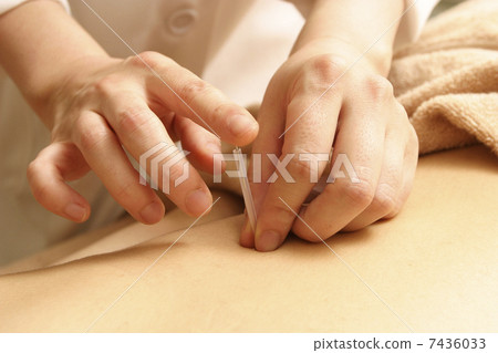 Acupuncture treatment Acupuncture treatment 7436033
