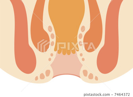 Anal cross section 7464372