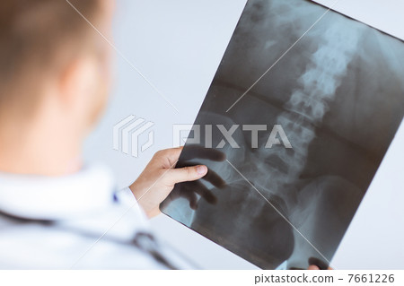 doctor holding x-ray or roentgen image 7661226