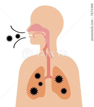 空氣感染 空氣感染 7674366