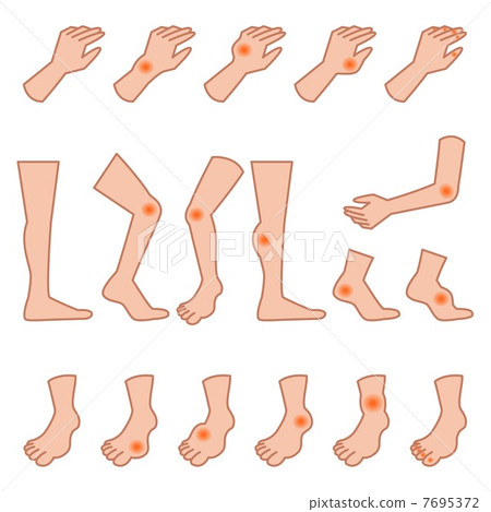 痛風和扭傷肢體設置 7695372