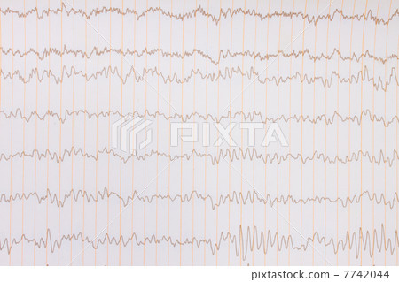 ECG background 7742044