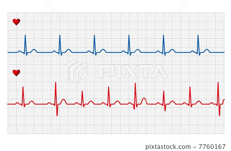 electro-cardiogram 7760167