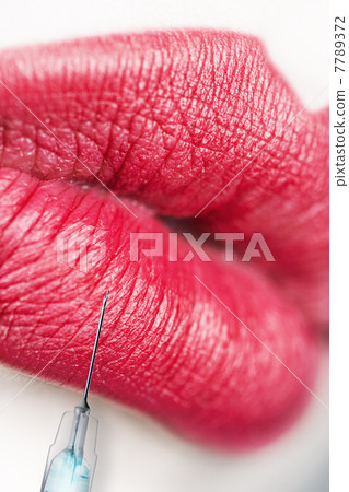 Lips injection. Beauty concept. 7789372
