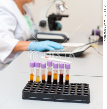 blood examination 7943120