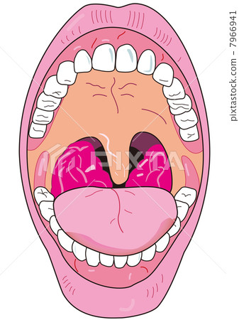 扁桃體肥大 7966941