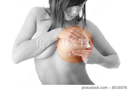 Breast cancer 8016076