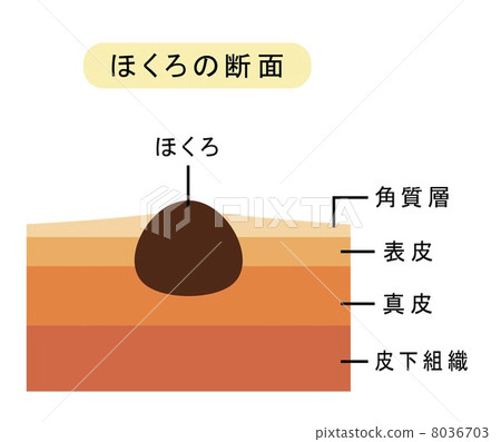 痣的橫截面 8036703