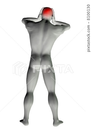 Man with headache 8100130
