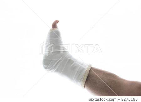 Fracture Gibbs right foot 8273195