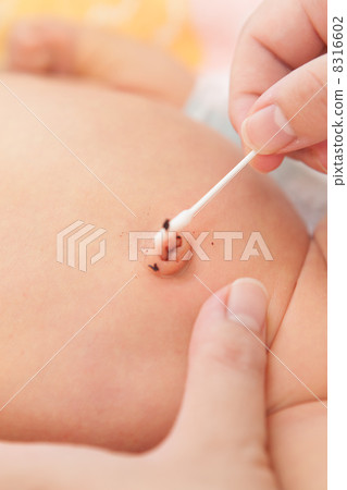 寶寶的肚臍護理 8316602