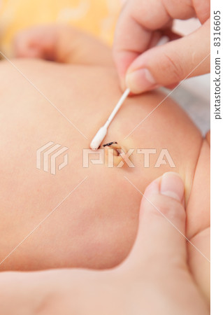Baby's navel care Baby's navel care 8316605