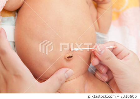 Baby's navel care 8316606