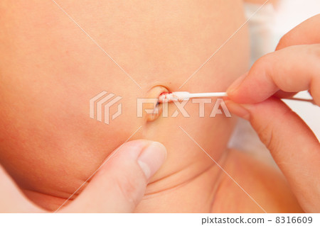 Baby's navel care 8316609