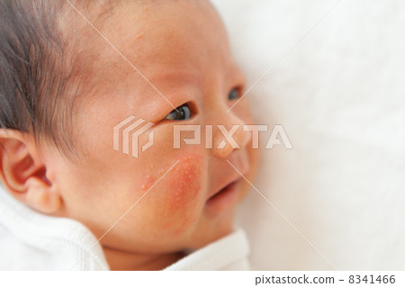 3rd week after birth 8341466
