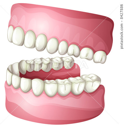 Denture 8427886