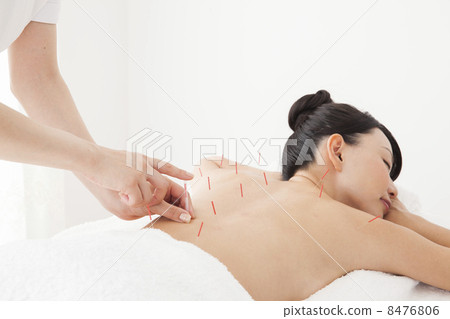 Acupuncture treatment Acupuncture treatment 8476806