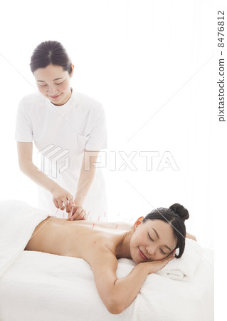 Acupuncture treatment 8476812