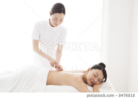 針灸治療 8476818