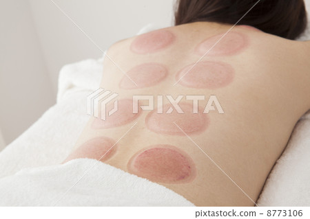 Suckling therapy 8773106