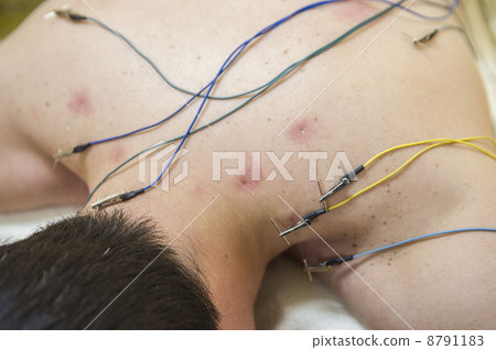 Acupuncture 8791183