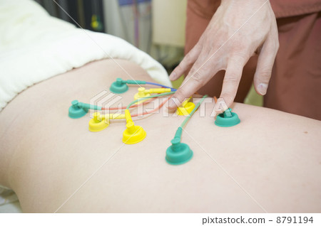 Acupuncture Acupuncture 8791194