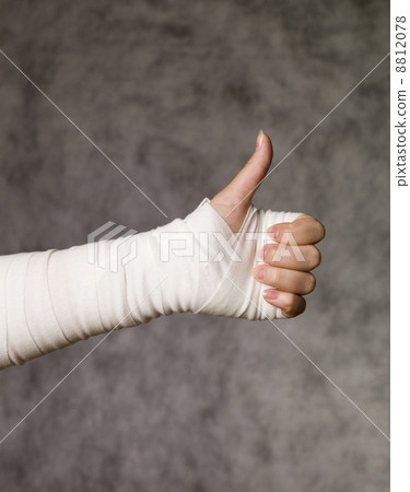 Stock Photo: broken, finger, nails