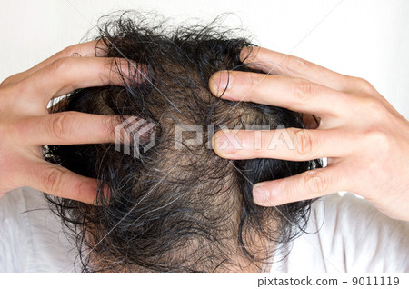 頭髮生長 頭髮生長 9011119