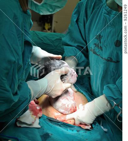 cesarean section cesarean section 9261249