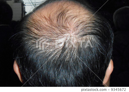 Light hair Light hair 9345672