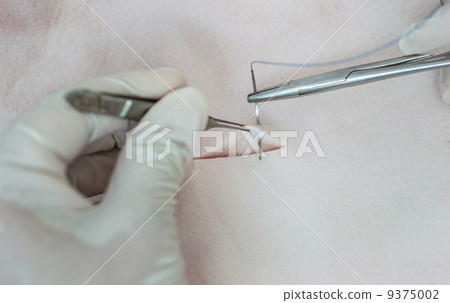 Suture skin 9375002