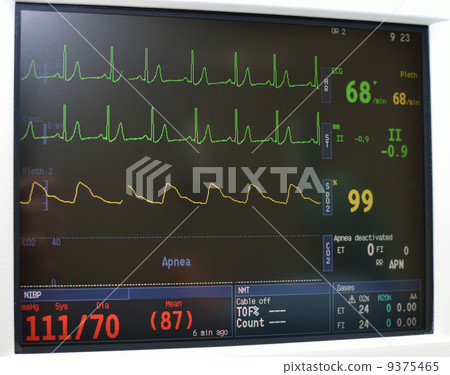 Monitor display 9375465