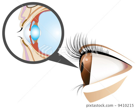 Transverse eye 9410215