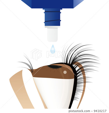 Instillation 9410217