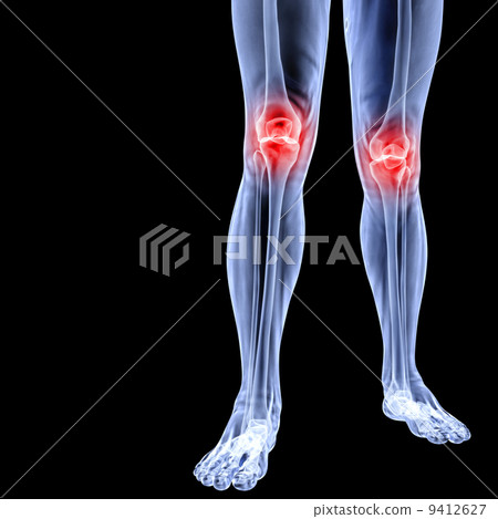 leg 9412627