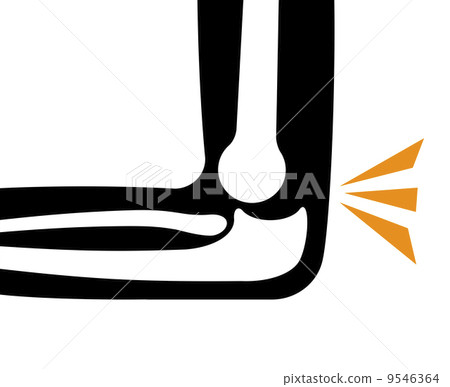 Elbow joint dislocation - Stock Illustration [9546364] - PIXTA