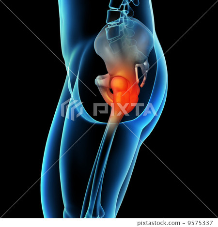 painful hip joint painful hip joint 9575337