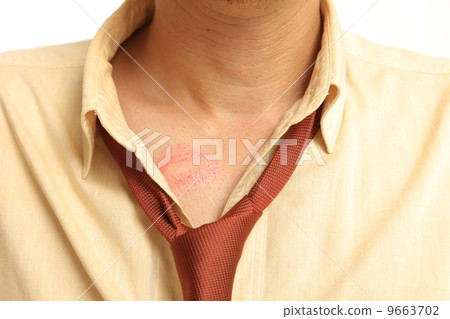 A man with a kiss mark 9663702