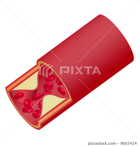 血管 血管 9683424