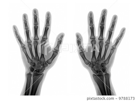 Roentgenogram 9788173