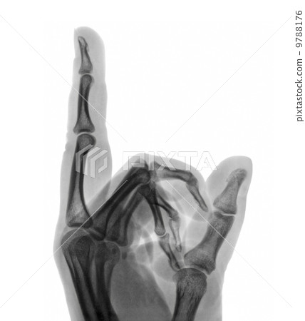 Roentgenogram 9788176