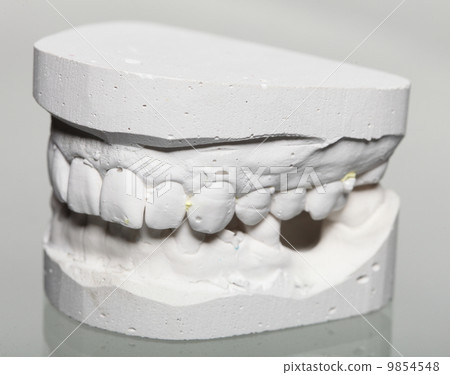 Dental gypsum model mould of teeth in plaster Dental gypsum model mould of teeth in plaster 9854548