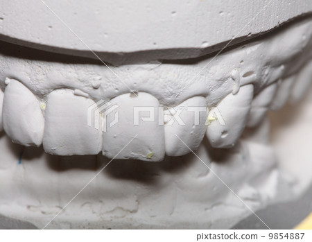 Dental gypsum model mould of teeth in plaster 9854887