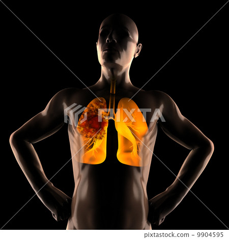 human chest radiography scan 9904595