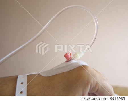 Patient's hand in the hospital with an IV 9918985