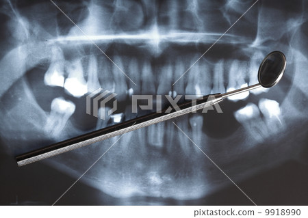 X-ray scan of humans teeth 9918990