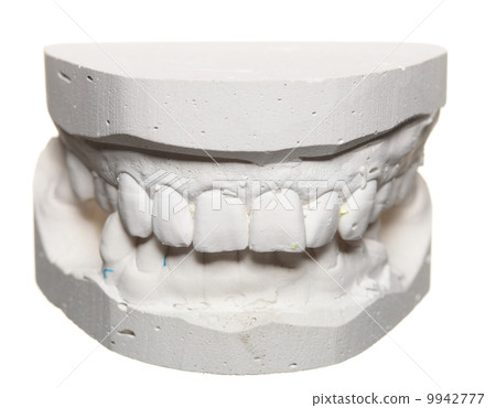 Dental gypsum model mould of teeth in plaster 9942777