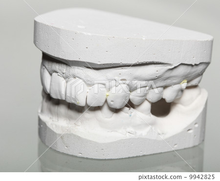 Dental gypsum model mould of teeth in plaster 9942825