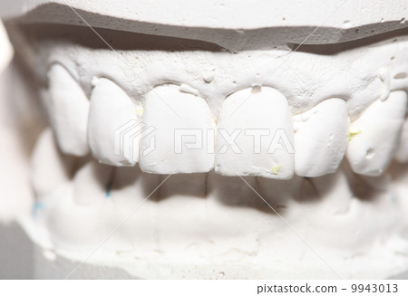 Dental gypsum model mould of teeth in plaster Dental gypsum model mould of teeth in plaster 9943013